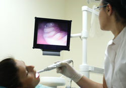 Intraoral Camera in Berkeley, CA